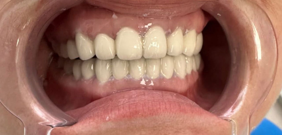 После
